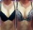 Témoignage anonyme pour grossir les seins